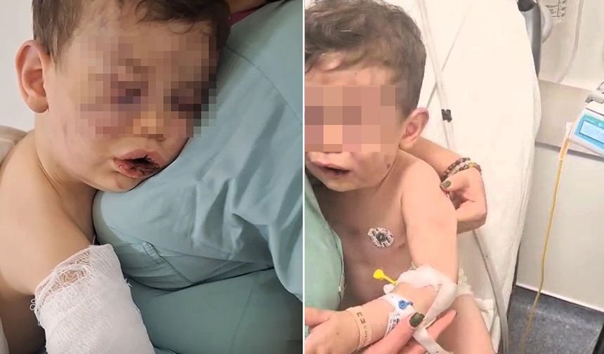 Denizli'de vahşet! 2 yaşındaki çocuk annesinin erkek arkadaşı tarafından darp edildi!