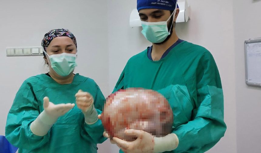 Doktorlar şaşkına döndü: Kadının karnından dev kitle çıkarıldı