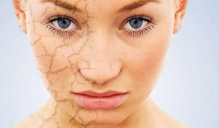Soğuk havalarda cilt kuruluğuna son! İşte 10 etkili tavsiye