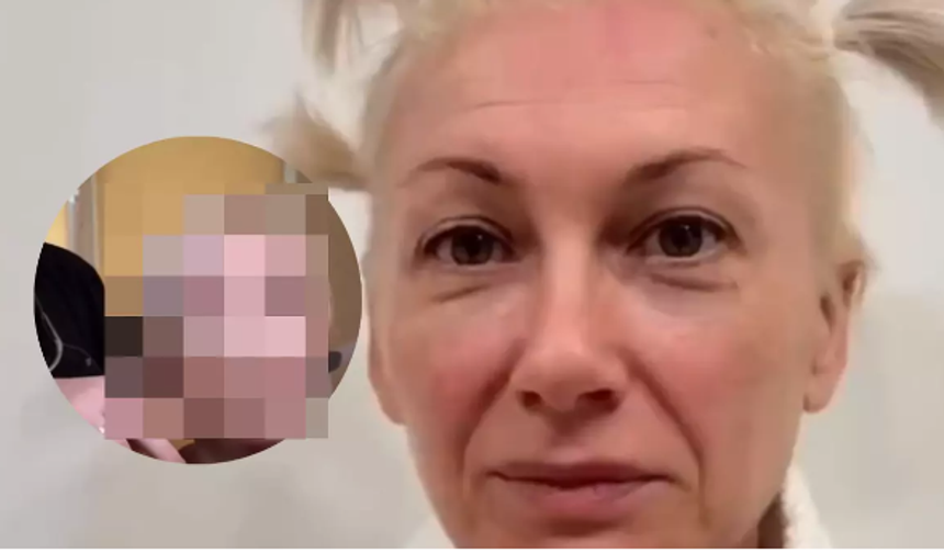 İzleyenler gözlerine inanamadı: 'Estetikle 20 yaş gençleşti'