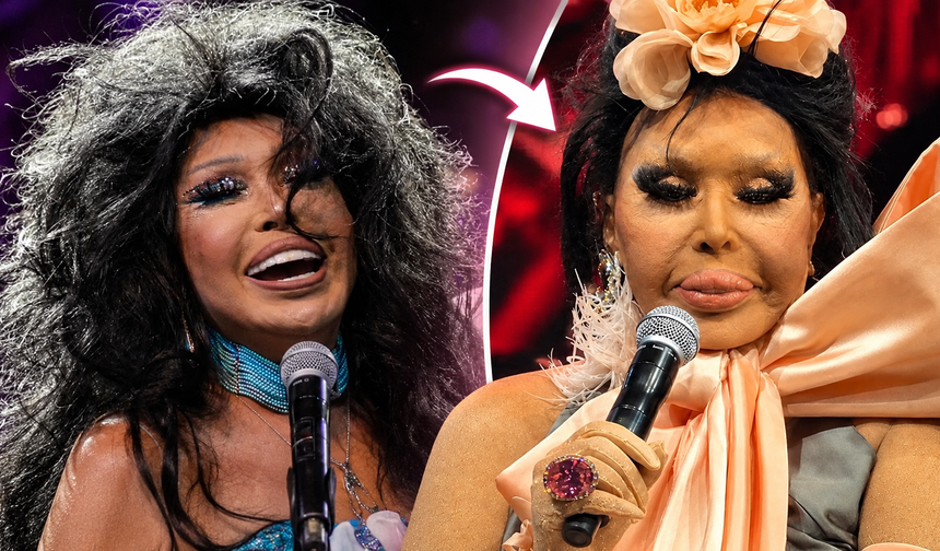 Bülent Ersoy yüzünü 'lolita gibi' yaptırmıştı! Aylar sonra böyle görüntülendi