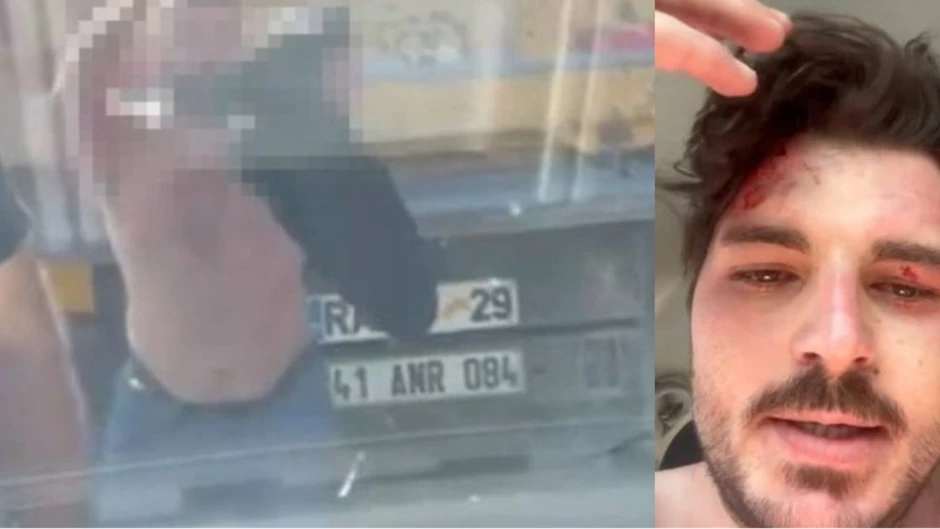 Bahar Dizisinin Gokhani Trafikteki Yol Kavgasinda 4 Kisi Tarafindan Dovuldu Pzve