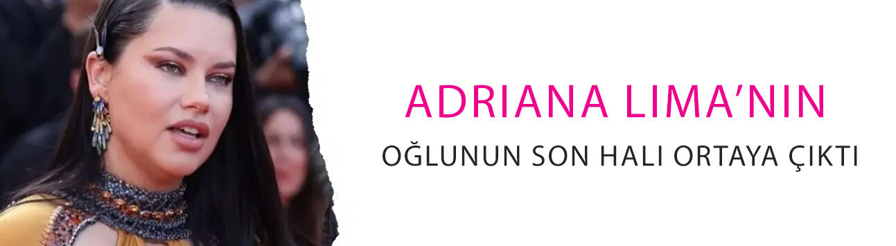 Annesini balon gibi şişirmişti: Adriana Lima’nın oğlunun son hali ortaya çıktı!