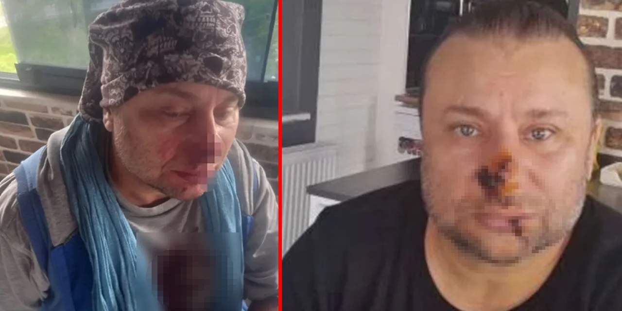 Unlu Sarkicinin Yuzu Curumeye Basladi Entube Edildi 3