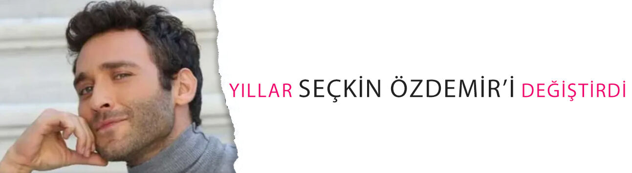 Yıllar Seçkin Özdemir’i değiştirdi! Ünlü oyuncunun son hali gündem oldu