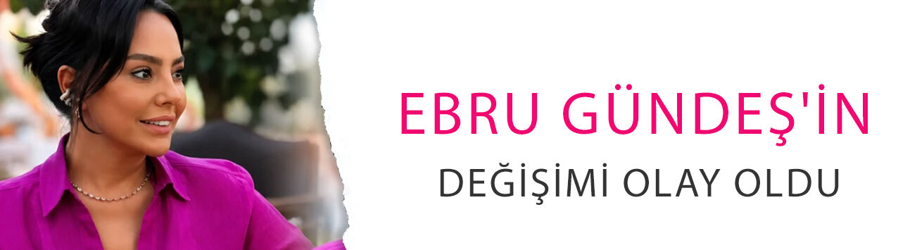 Ebru Gündeş'in değişimi olay oldu! 10 milyon TL'lik estetik sonrası bambaşka