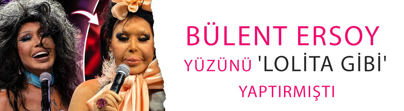 Bülent Ersoy yüzünü 'lolita gibi' yaptırmıştı! Aylar sonra böyle görüntülendi